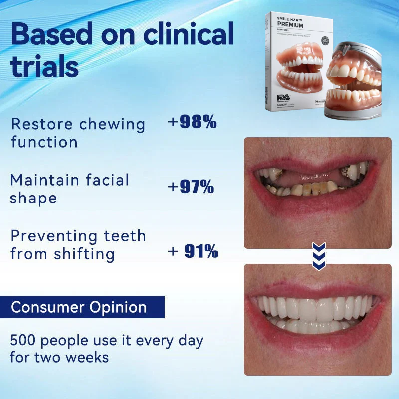 Amtnclub | HZA™ – Prothèse dentaire complète sur mesure pour un sourire naturel