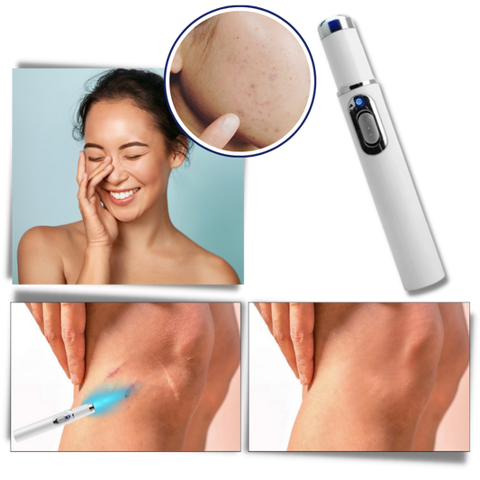 Amtn Club | Thérapie Laser Portable pour une Peau Éclatante – DermaPure