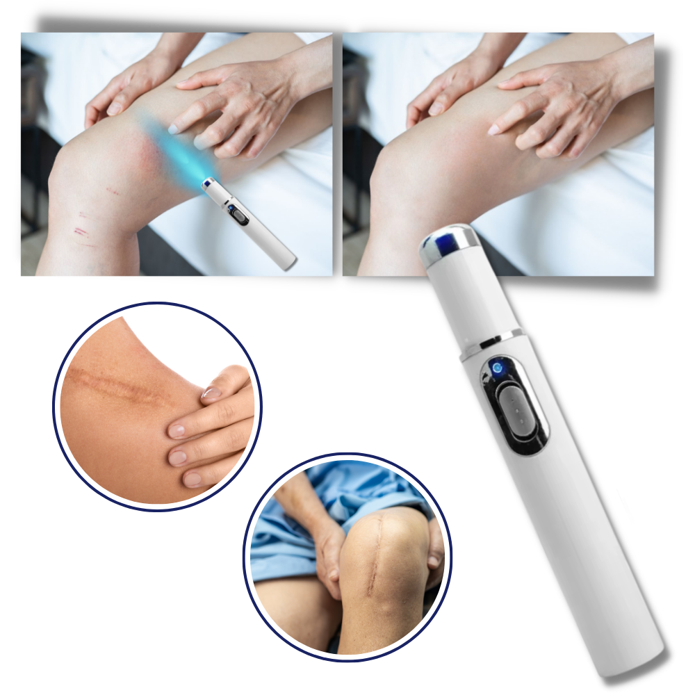 Amtn Club | Thérapie Laser Portable pour une Peau Éclatante – DermaPure