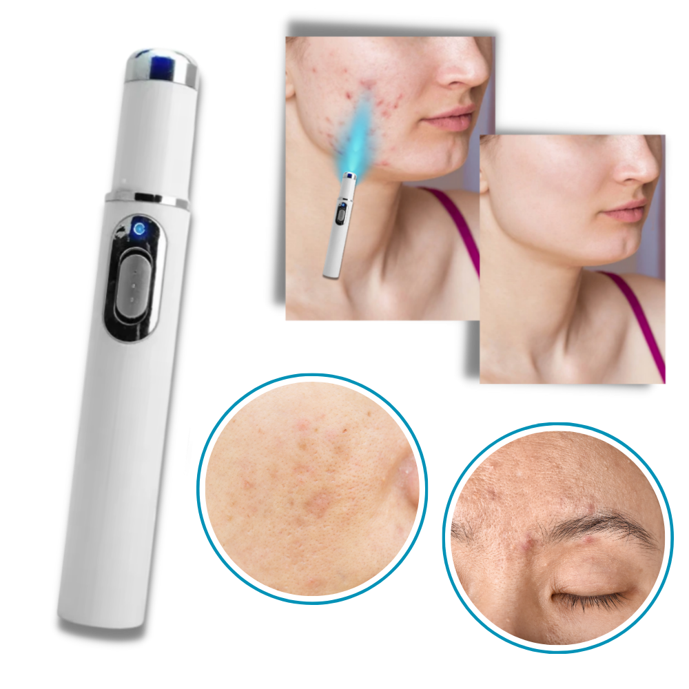 Amtn Club | Thérapie Laser Portable pour une Peau Éclatante – DermaPure