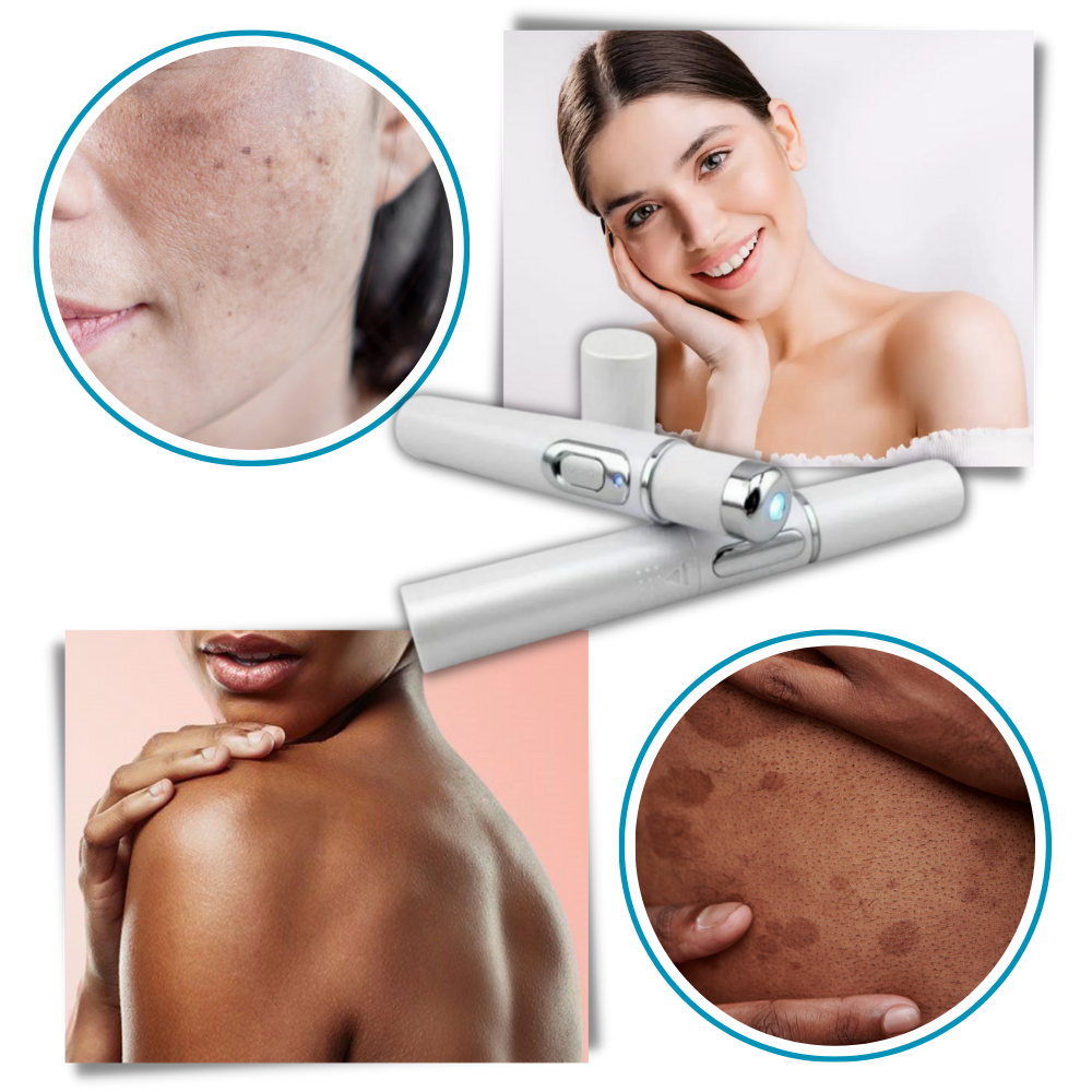 Amtn Club | Thérapie Laser Portable pour une Peau Éclatante – DermaPure