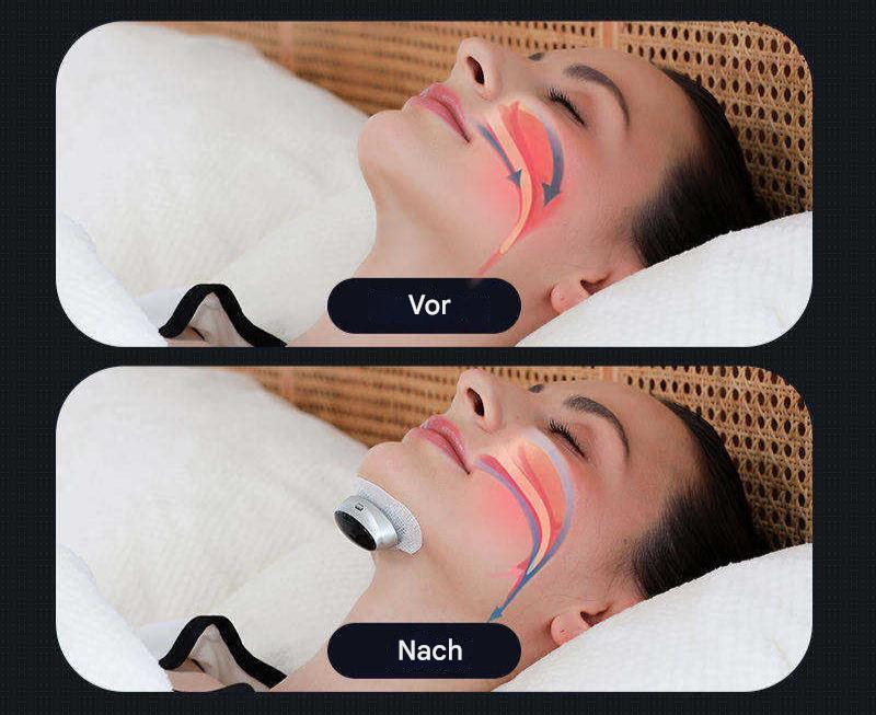 Amtn Club | Appareil Apnée du Sommeil Compact – AirEase