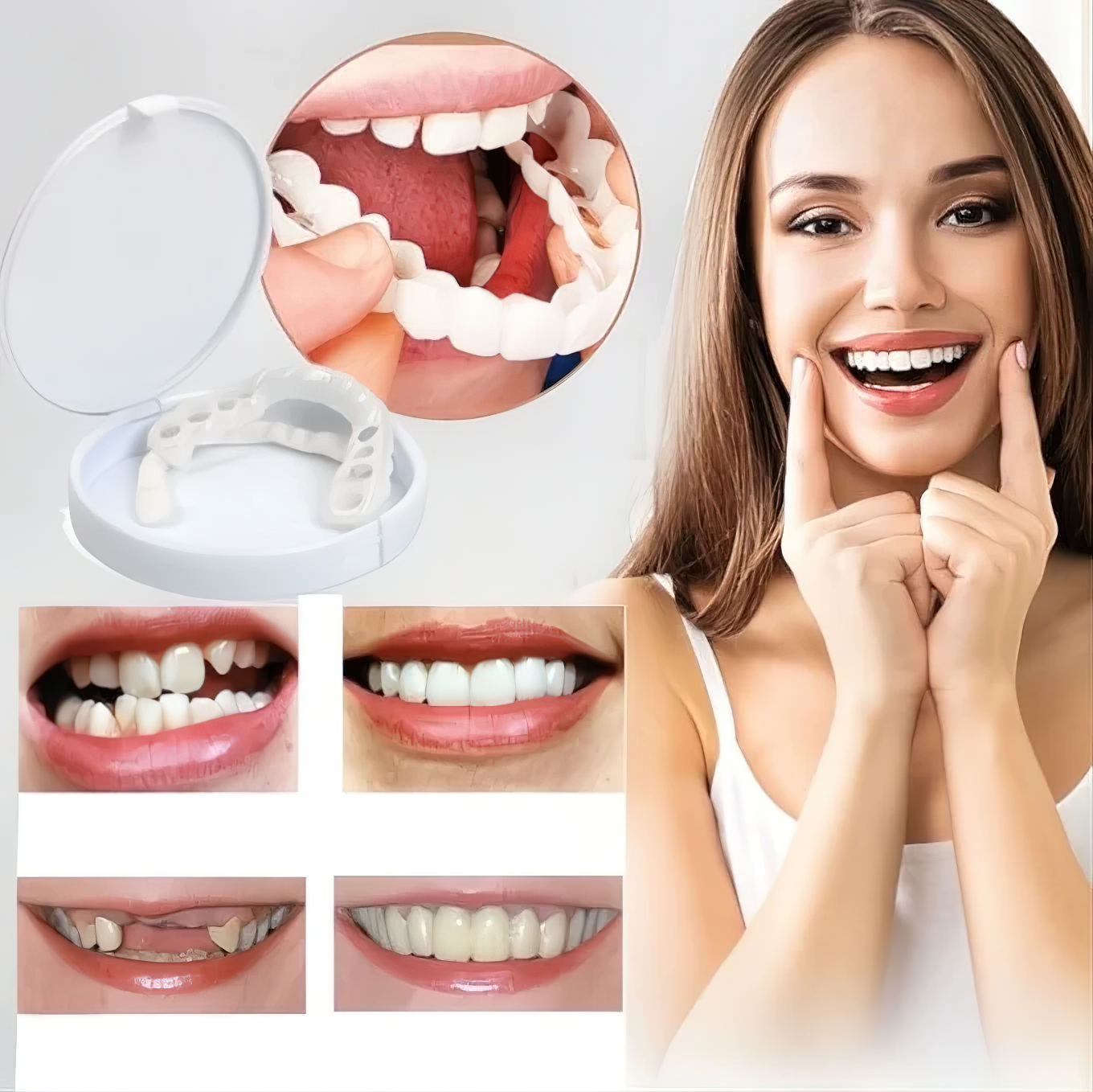 Facettes Dentaires Effet Blanc Naturel – Amtn Club